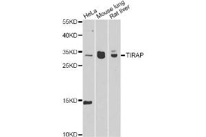 Western blot analysis of extracts of various cell lines, using TIRAP antibody. (TIRAP 抗体)