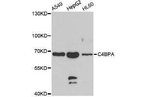 Western blot analysis of extracts of various cell lines, using C4BPA antibody (ABIN2736376) at 1:1000 dilution. (C4BPA 抗体)