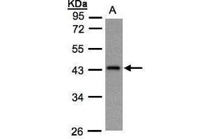 WB Image Sample(30 ug whole cell lysate) A:Hep G2 , 10% SDS PAGE antibody diluted at 1:1000 (GNaZ 抗体  (Center))