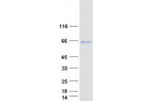 Western Blotting (WB) image for serpin Peptidase Inhibitor, Clade A (Alpha-1 Antiproteinase, Antitrypsin), Member 10 (SERPINA10) (Transcript Variant 1) protein (Myc-DYKDDDDK Tag) (ABIN2731734)