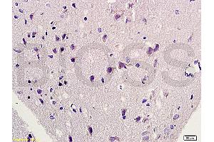 Formalin-fixed and paraffin embedded rat brain labeled with Rabbit Anti-HSP27/HspB1/HSP25 Polyclonal Antibody, Unconjugated (ABIN672441) at 1:200 followed by conjugation to the secondary antibody and DAB staining. (HSP27 抗体  (AA 101-205))