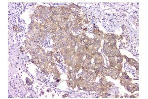 IHC analysis of WWOX using anti-WWOX antibody (ABIN6719627). (WWOX 抗体  (AA 1-245))