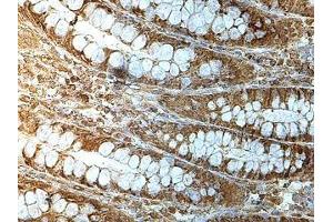 Immunohistochemistry (IHC) image for anti-Makorin Ring Finger Protein 3 (MKRN3) antibody (ABIN1855943) (MKRN3 抗体)