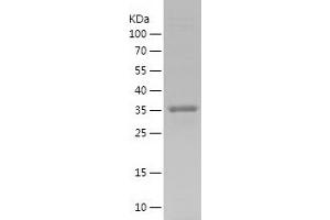 Western Blotting (WB) image for Solute Carrier Family 2 (Facilitated Glucose Transporter), Member 3 (SLC2A3) (AA 449-496) protein (His-IF2DI Tag) (ABIN7282337) (SLC2A3 Protein (AA 449-496) (His-IF2DI Tag))