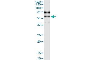 Immunoprecipitation of SIGLEC6 transfected lysate using anti-SIGLEC6 MaxPab rabbit polyclonal antibody and Protein A Magnetic Bead , and immunoblotted with SIGLEC6 purified MaxPab mouse polyclonal antibody (B01P) . (SIGLEC6 抗体  (AA 1-437))