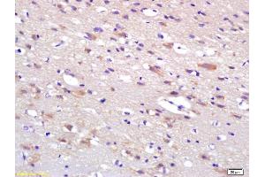 Formalin-fixed and paraffin embedded rat brain labeled with Anti-HIP2 Polyclonal Antibody, Unconjugated (ABIN1387369) at 1:200 followed by conjugation to the secondary antibody and DAB staining. (UBE2K 抗体  (AA 51-150))