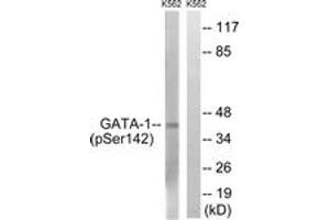 Western blot analysis of extracts from K562 cells, using GATA1 (Phospho-Ser142) Antibody. (GATA1 抗体  (pSer142))