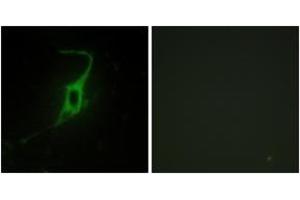Immunofluorescence analysis of NIH-3T3 cells, using CDH20 Antibody. (Cadherin 20 抗体  (AA 111-160))
