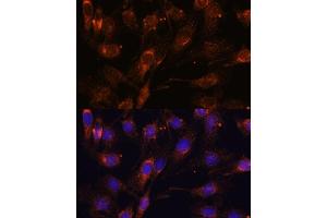 Immunofluorescence analysis of C6 cells using SC antibody (ABIN7270188) at dilution of 1:100. (SCAMP2 抗体  (AA 1-152))