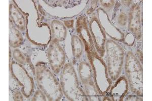 Image no. 4 for anti-Mitofusin 2 (MFN2) (AA 661-758) antibody (ABIN599101) (MFN2 抗体  (AA 661-758))