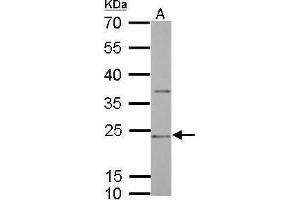 WB Image CD74 antibody [N1N2], N-term detects CD74 protein by Western blot analysis. (CD74 抗体  (N-Term))