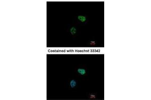 ICC/IF Image Immunofluorescence analysis of paraformaldehyde-fixed HeLa, using PSMC6, antibody at 1:500 dilution. (PSMC6 抗体)