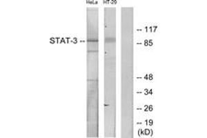 Western blot analysis of extracts from HeLa/HT-29 cells, using STAT3 (Ab-727) Antibody. (STAT3 抗体  (AA 694-743))