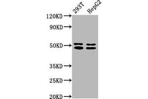 Western Blot Positive WB detected in: 293T whole cell lysate, HepG2 whole cell lysate All lanes: TRNT1 antibody at 5 μg/mL Secondary Goat polyclonal to rabbit IgG at 1/50000 dilution Predicted band size: 51, 48, 7 kDa Observed band size: 51, 48 kDa (Trnt1 抗体  (AA 128-293))