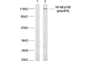 Western blot analysis of extract from MDA-MB-435 cells untreated or treated with TNF-alpha, (20 ng/mL, 5 min) using NF-κ,B p100(phospho-Ser870) antibody. (NFKB2 抗体  (pSer870))