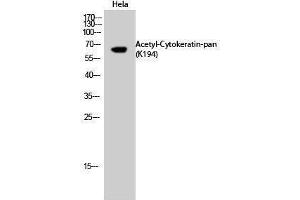 Western Blotting (WB) image for anti-Keratin 1 (KRT1) (acLys194) antibody (ABIN3181898) (Cytokeratin 1 抗体  (acLys194))