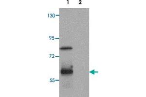 Western blot analysis of RASSF10 in human lung tissue lysate with RASSF10 polyclonal antibody  at 1 ug/mL. (RASSF10 抗体  (N-Term))