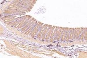 Immunohistochemistry (Paraffin-embedded Sections) (IHC (p)) image for anti-Kinesin Family Member 5B (KIF5B) antibody (ABIN7074440)