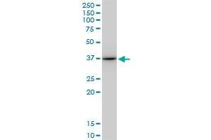 ANXA1 monoclonal antibody (M10), clone 2D11. (Annexin a1 抗体  (AA 1-346))