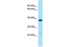 WB Suggested Anti-NXNL1 Antibody Titration: 1. (NXNL1 抗体  (C-Term))