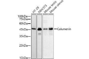 Western blot analysis of extracts of various cell lines, using (ABIN7266050) at 1:500 dilution. (CALU 抗体)