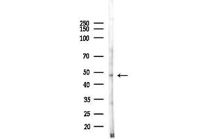 Western blot analysis of lysates from Hela cells(heat-shock 45 min treatment), using CEP55 Antibody at 1/1000 dilution.