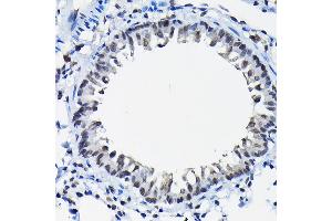 Immunohistochemistry of paraffin-embedded rat lung using SSN Rabbit pAb (3377) at dilution of 1:100 (40x lens). (SSNA1 抗体  (AA 1-119))