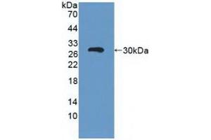 Detection of Recombinant ABCC3, Human using Polyclonal Antibody to ATP Binding Cassette Transporter C3 (ABCC3) (ABCC3 抗体  (AA 1291-1523))