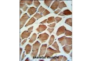 CA5B Antibody (C-term) (ABIN652315 and ABIN2841444) IHC analysis in formalin fixed and paraffin embedded human skeletal muscle followed by peroxidase conjugation of the secondary antibody and DAB staining. (CA5B 抗体  (C-Term))