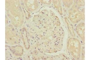 Immunohistochemistry of paraffin-embedded human kidney tissue using ABIN7148059 at dilution of 1:100 (CCHCR1 抗体  (AA 483-782))
