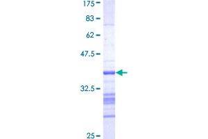 Aurora Kinase B Protein (AURKB) (AA 1-90) (GST tag)