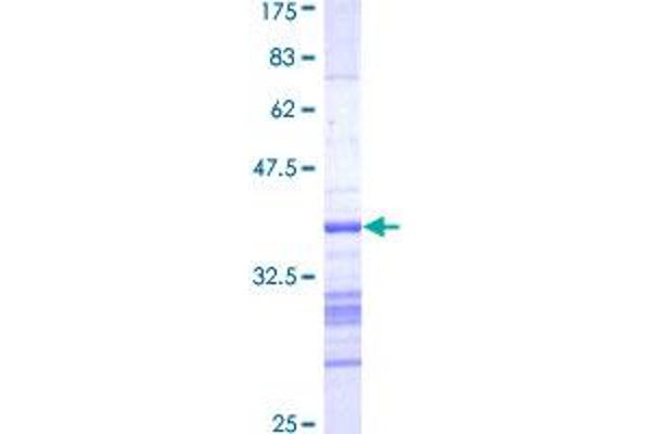 Aurora Kinase B Protein (AURKB) (AA 1-90) (GST tag)