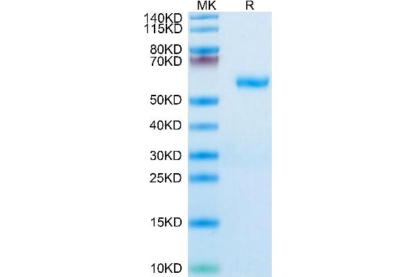 RNF34 Protein (AA 24-197) (Fc Tag)