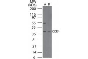 Image no. 1 for anti-Chemokine (C-C Motif) Receptor 4 (CCR4) (AA 337-351) antibody (ABIN1100490) (CCR4 抗体  (AA 337-351))