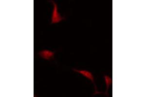 ABIN6266862 staining COLO205 by IF/ICC. (MAPKAP Kinase 3 抗体  (C-Term))