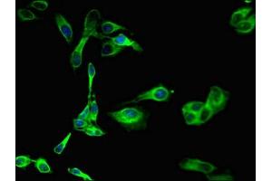 Immunofluorescent analysis of Hela cells using ABIN7169176 at dilution of 1:100 and Alexa Fluor 488-congugated AffiniPure Goat Anti-Rabbit IgG(H+L) (SGK1 抗体  (AA 247-406))