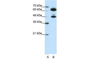 WB Suggested Anti-SNRP70  Antibody Titration: 0. (SNRNP70 抗体  (C-Term))