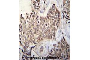 ZBTB42 Antibody (N-term) immunohistochemistry analysis in formalin fixed and paraffin embedded human breast tissue followed by peroxidase conjugation of the secondary antibody and DAB staining.