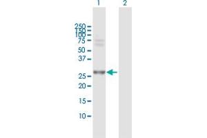 Western Blot analysis of PSMA7 expression in transfected 293T cell line by PSMA7 MaxPab polyclonal antibody. (PSMA7 抗体  (AA 1-248))
