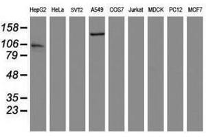 Image no. 2 for anti-ATP/GTP Binding Protein 1 (AGTPBP1) (AA 368-753) antibody (ABIN1491462) (AGTPBP1 抗体  (AA 368-753))
