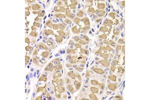 Immunohistochemistry of paraffin-embedded Human gastric using RAMP1 antibody at dilution of 1:100 (x400 lens). (RAMP1 抗体)