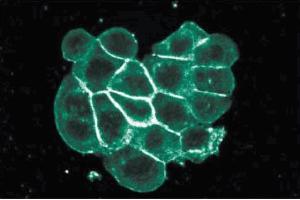 Immunofluorescence staining of WiDr cells (Human colorectal adenocarcinoma, ATCC CCL-218). (ITGA2 抗体  (AA 42-245))