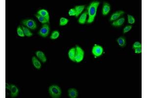 Immunofluorescence staining of HepG2 cells with  at 1:133, counter-stained with DAPI. (GAB1 抗体  (AA 119-329))