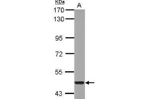 Western Blotting (WB) image for anti-Cytochrome P450, Family 26, Subfamily A, Polypeptide 1 (CYP26A1) (Center) antibody (ABIN2856004)