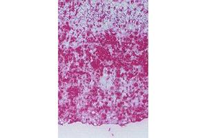 Detection of HEL at Human atherosclerotic lesions. (N epsilon Hexanoyl-Keyhole Limpet Hemocyanin (HEL-KLH) 抗体)