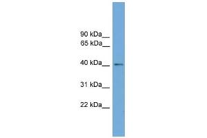 WB Suggested Anti-ZDHHC18 Antibody Titration:  0. (ZDHHC18 抗体  (Middle Region))