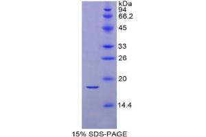 SDS-PAGE analysis of Mouse RBP2 Protein.