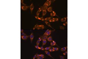 Immunofluorescence analysis of NIH-3T3 cells using DLDH/DLD Rabbit mAb (ABIN7266766) at dilution of 1:100 (40x lens).