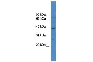 WB Suggested Anti-SOX1 Antibody Titration:  0. (SOX1 抗体  (N-Term))