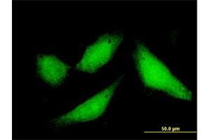 Immunofluorescence of purified MaxPab antibody to CPXCR1 on HeLa cell. (CPXCR1 抗体  (AA 1-301))